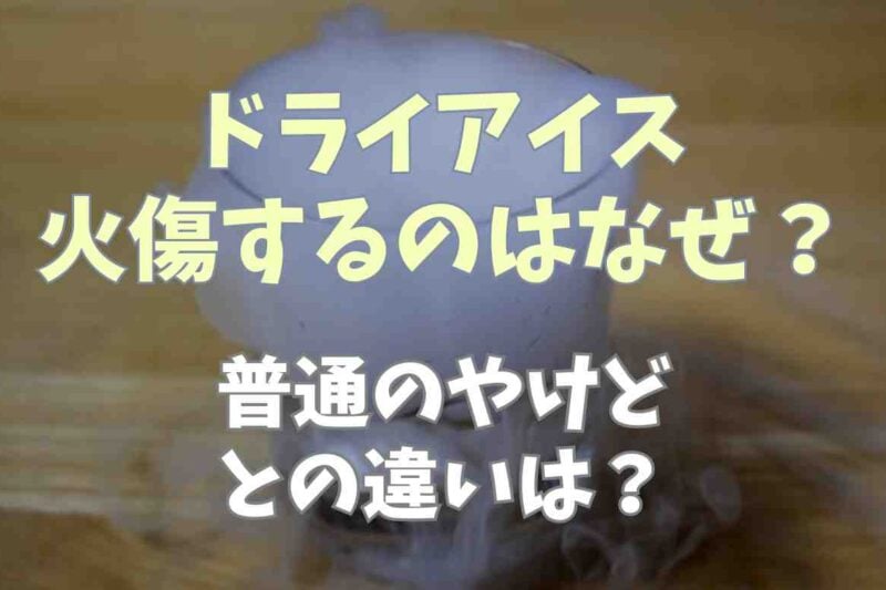 ドライアイスでやけどするのはなぜ？普通のやけどとの違いや対処方法も調査